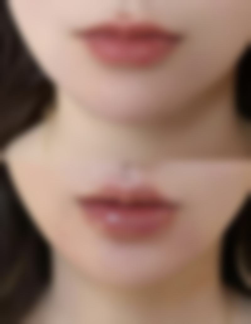 四、埋线后抽线多久可以做割双眼皮