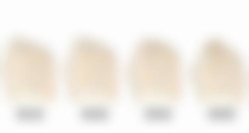 三、做了双眼皮眼睛会变大吗?手术方式及选择