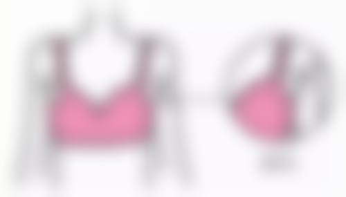 五、做了双眼皮眼睛会变大吗?个性化设计特别重要