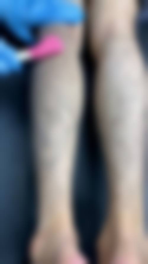 六、韩国Trueman男科医院价格表