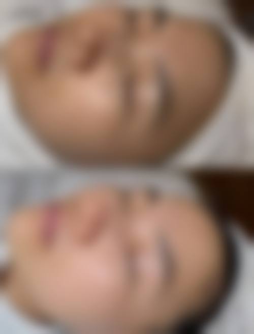 九、韩国SHE’S整形外科医院真实的患者评价