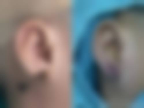 二、山东潍坊博雅整形医院怎么样？