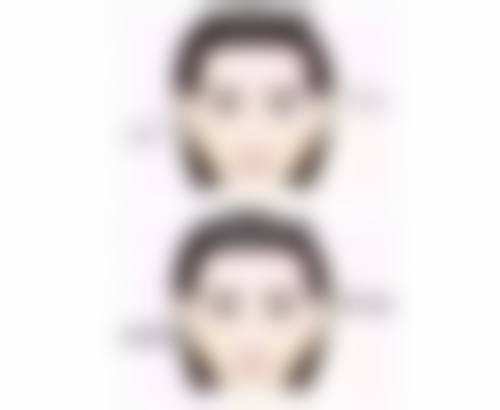 种植头发价位贵吗？总结