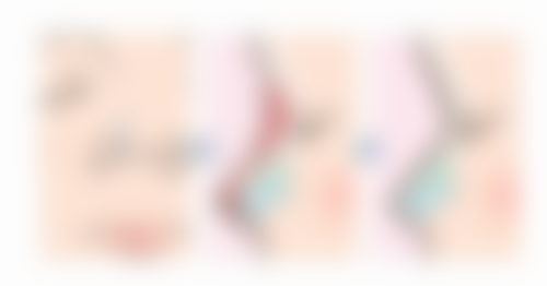 四、手术疤痕痒需就医的情况