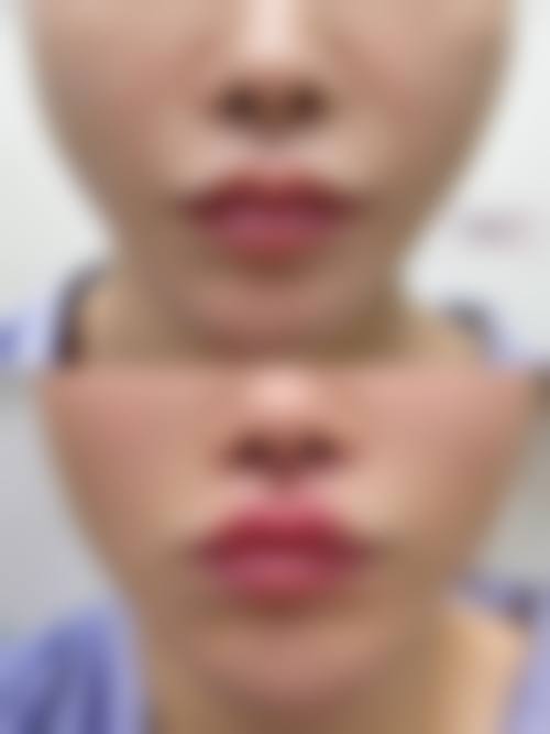 五、福州芙美医文华医疗美容诊所价格表