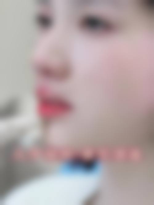 四、福州芙美医文华医疗美容诊所特色项目