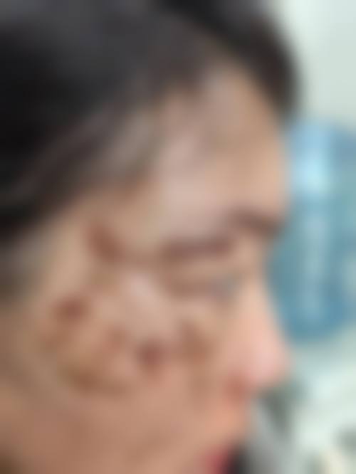 三、陈青叶技术优势