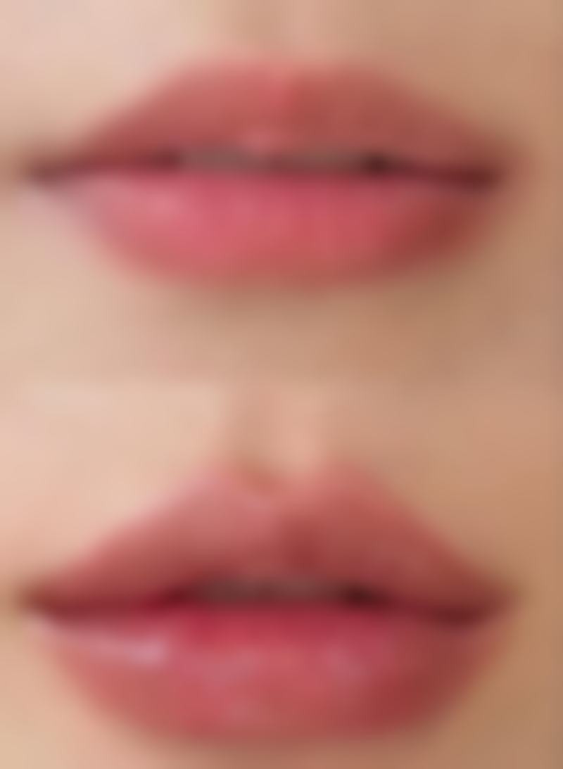 六、手术疤痕痒的饮食和生活注意事项