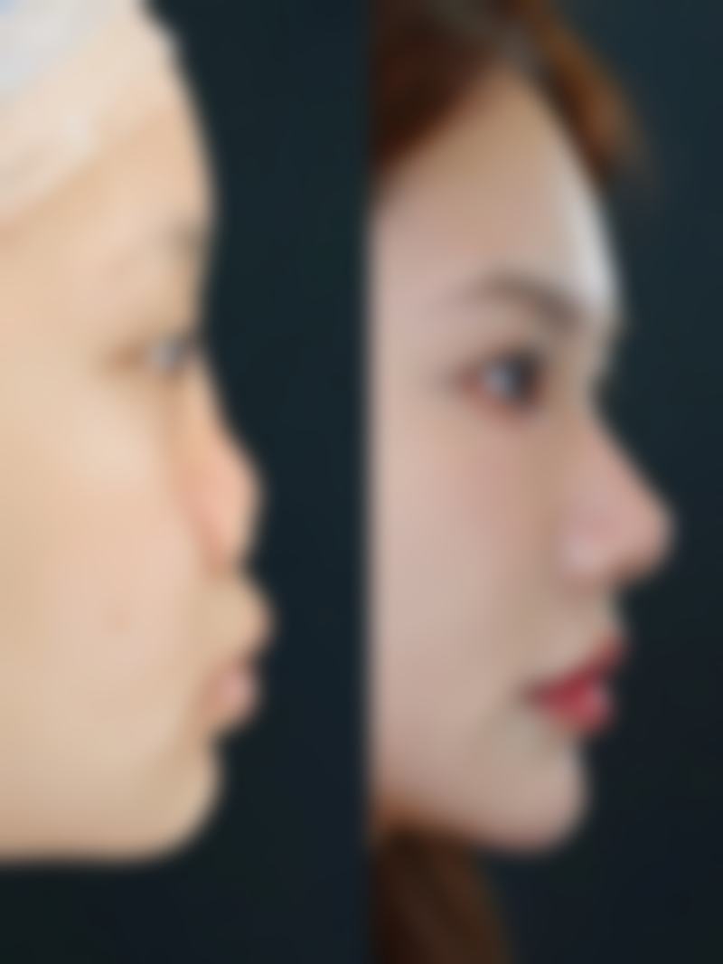 九、珠海华美美容医疗整形真实的患者评价