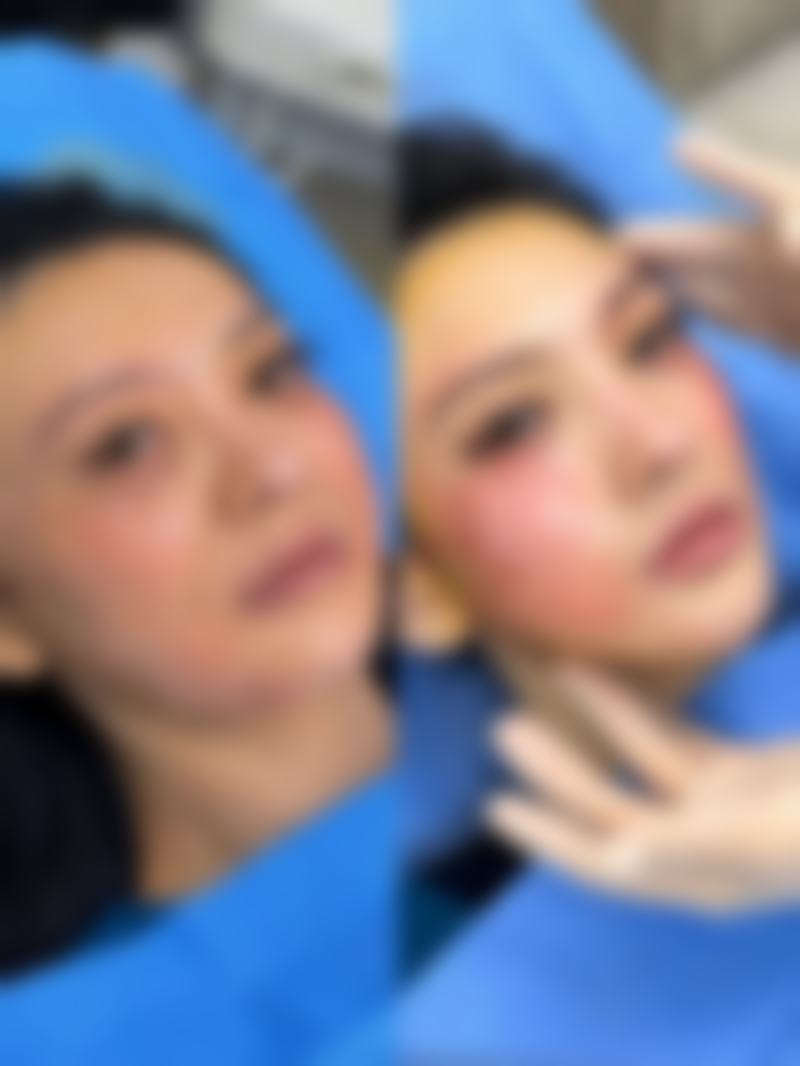 三、影响种植头发价格的核心因素