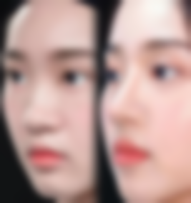 三、韩国媄琳皮肤整形医院诊疗项目有哪些?