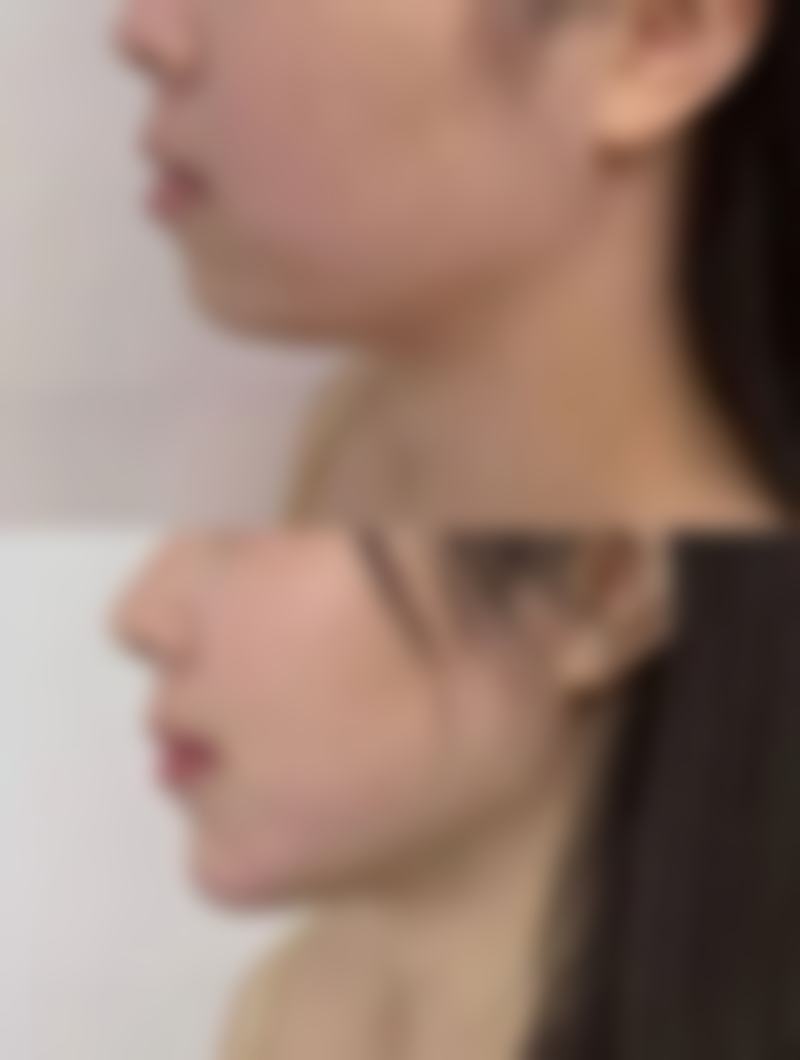 五、如何确定种植头发的价格