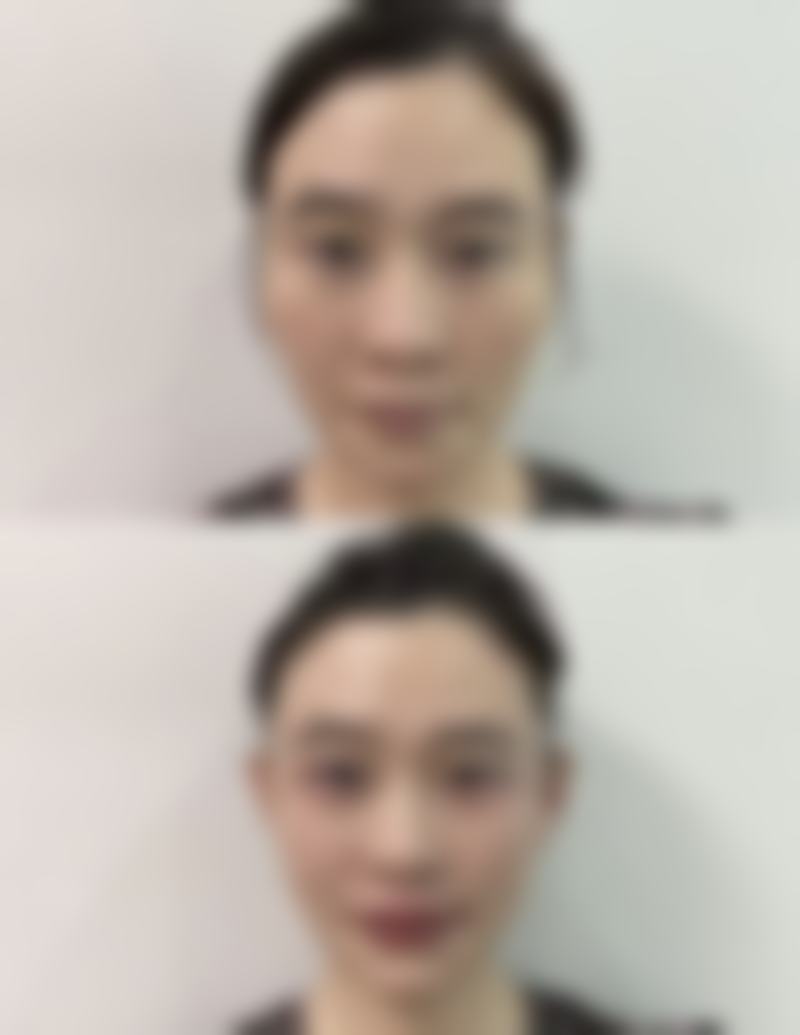 二、韩国媄琳皮肤整形医院怎么样?