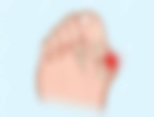 三、王文医生擅长技术