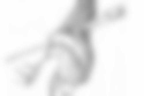 抽脂双下巴会反弹吗？