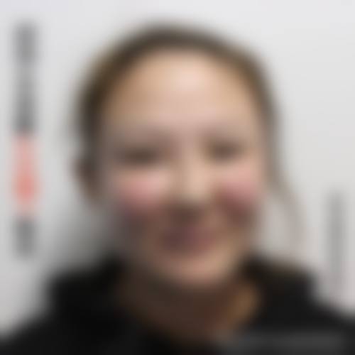 二、东莞美熙伊美医疗美容怎么样？