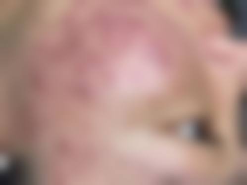 五、刘现英怎么预约？