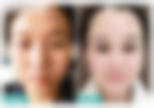 六、韩国KAIROS整容外科价格表