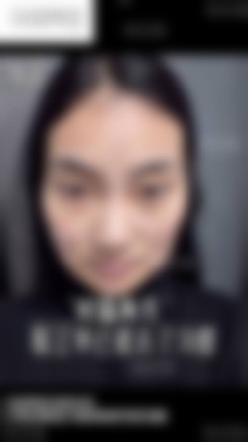 四、韩国KAIROS整容外科特色项目