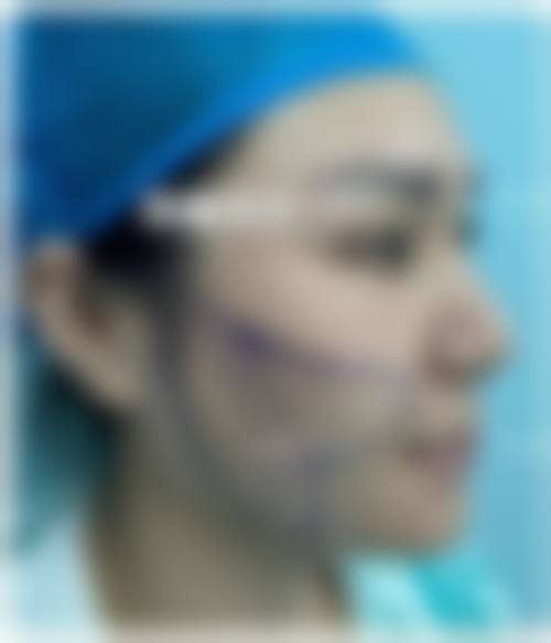 四、东莞美熙伊美医疗美容特色项目