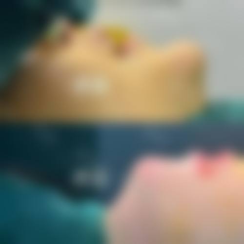 五、东莞美熙伊美医疗美容价格表