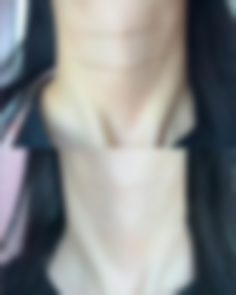 五、治疗注意事项