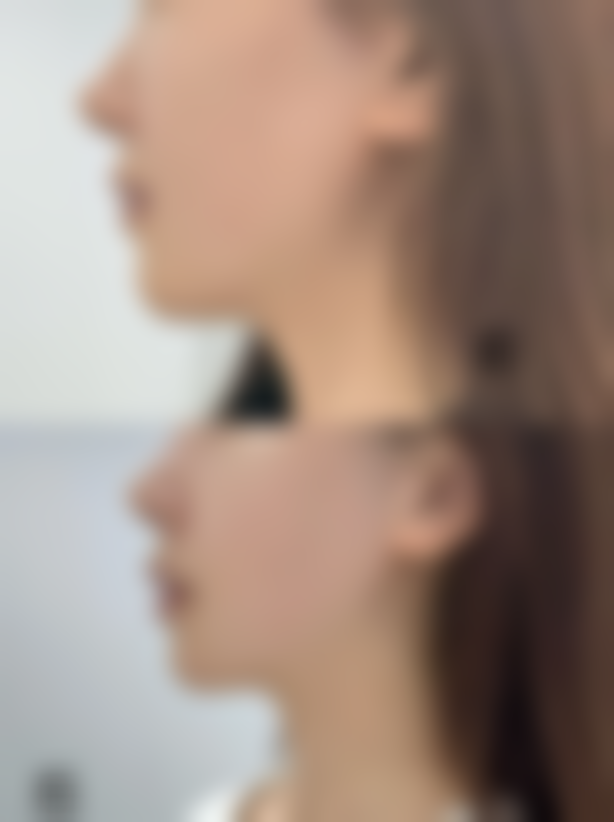 身上疤痕色素沉淀怎么消除？这些小妙招助你淡化疤痕色素恢复肌肤健康 