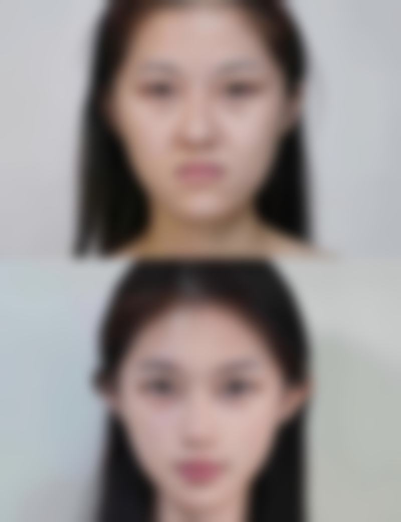 四、王文医生技术优势