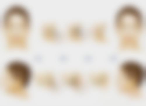 三、韩式双眼皮的适合人群