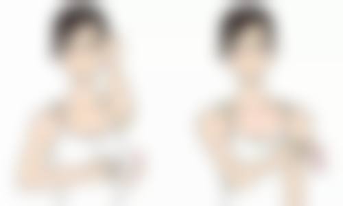 一、双眼皮手术常见副作用大盘点