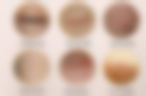 四、韩式双眼皮与传统全切法的优缺点对比