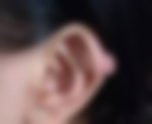 五、术后促进修复的其他建议