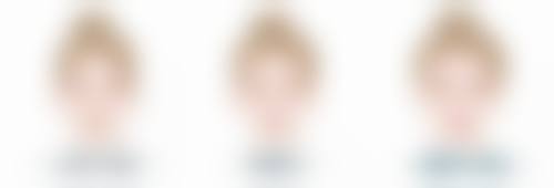 三、割完双眼皮喝咖啡的注意事项