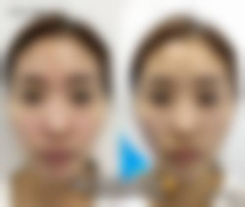 二、广西 南宁柏琳悦美整形怎么样?