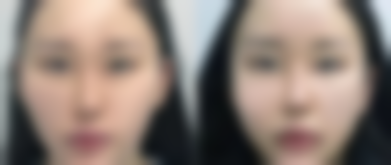 八、山西太原时光整形美容医院预约方式