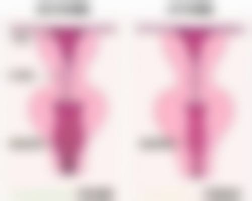 五、其他辅助注意要点