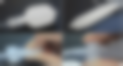 二、割双眼皮自然要多久：影响修复时间的因素