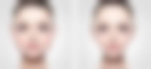 三、注射瘦脸针后的护理关键