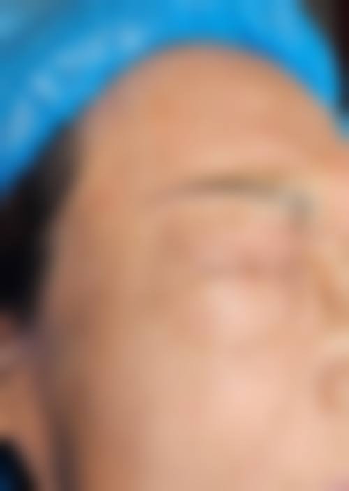 五、济南合美医疗美容门诊部价格表