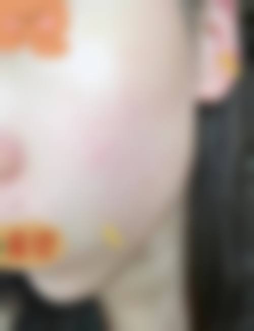 八、济南合美医疗美容门诊部真实的患者评价