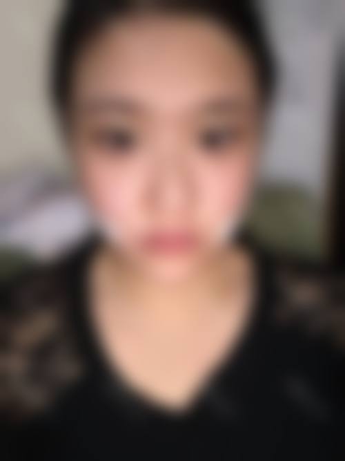 四、新疆王茜医疗整形门诊部特色项目