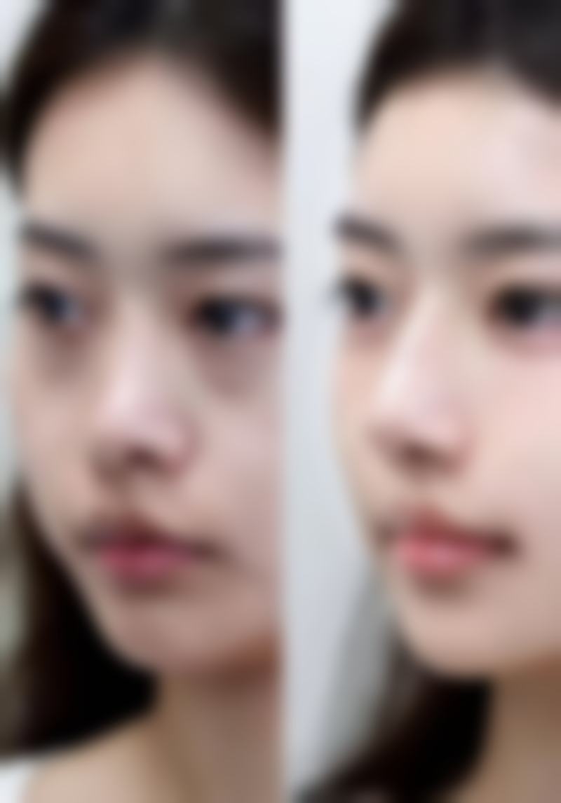 四、铁岭美嘉丽整形医院特色项目