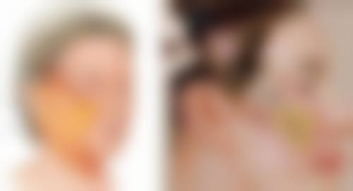 六、隆鼻膨体常见问题解答