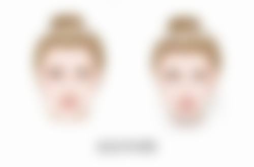 哪种隆胸方式比较好？假体、自体脂肪、复合隆胸各有优势大揭秘