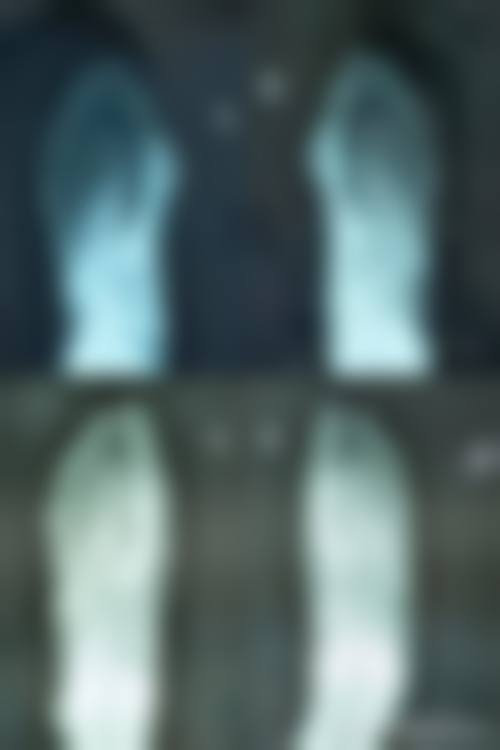 九、瑞丽伊姿整形医院真实的患者评价