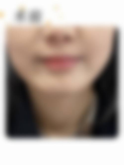 三、瑞丽伊姿整形医院诊疗项目有哪些？