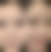 一、什么眼霜可以消除眼袋：眼袋形成的原因和类型