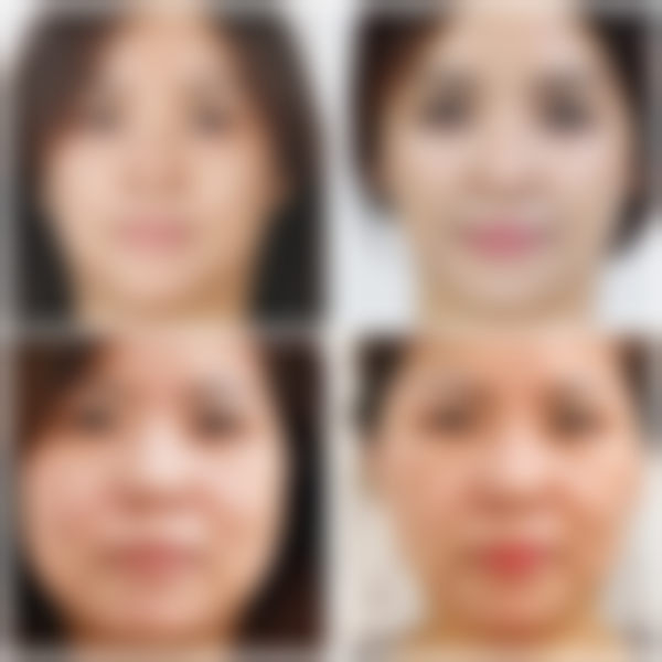 三、韩国ARTLINE皮肤科整形医院诊疗项目有哪些？