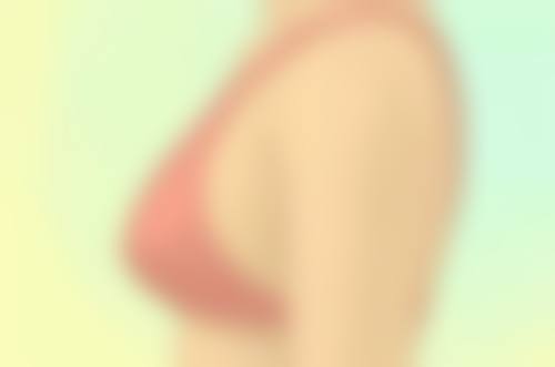 五、全切双眼皮一个月的其他饮食禁忌