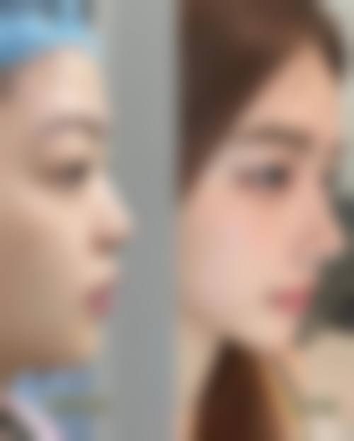 八、韩国ARTLINE皮肤科整形医院真实的患者评价